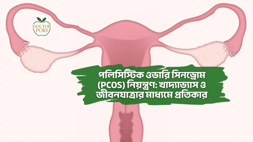 পলিসিস্টিক ওভারি সিনড্রোম (PCOS) নিয়ন্ত্রণ: খাদ্যাভ্যাস ও জীবনযাত্রার মাধ্যমে প্রতিকার