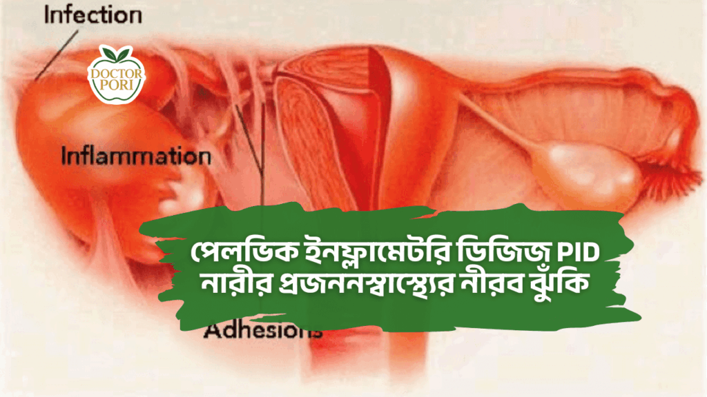 পেলভিক ইনফ্লামেটরি ডিজিজ PID নারীর প্রজননস্বাস্থ্যের নীরব ঝুঁকি