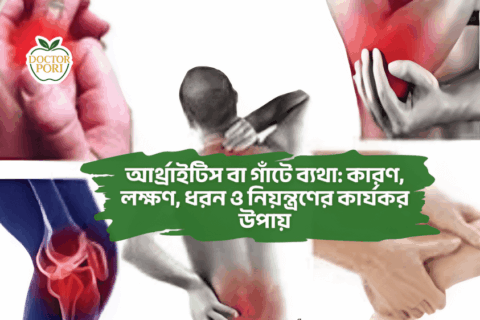 আর্থ্রাইটিস বা গাঁটে ব্যথা: কারণ, লক্ষণ, ধরন ও নিয়ন্ত্রণের কার্যকর উপায়