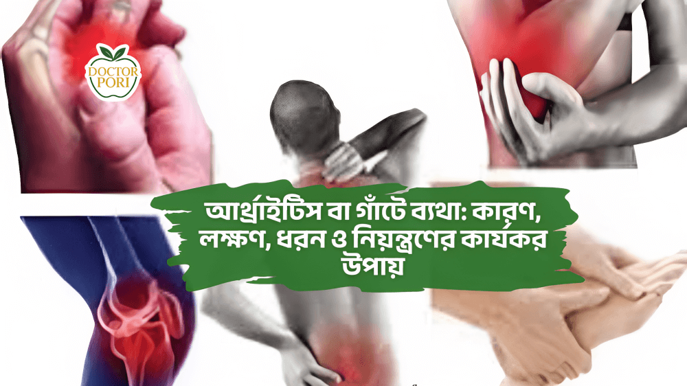 আর্থ্রাইটিস বা গাঁটে ব্যথা: কারণ, লক্ষণ, ধরন ও নিয়ন্ত্রণের কার্যকর উপায়